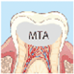 MTAセメント