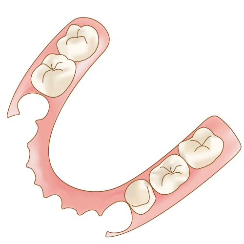 メタルフリー義歯